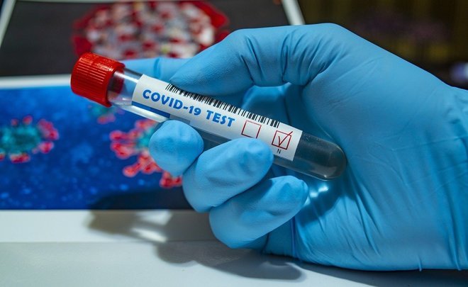 В Роспотребнадзоре Татарстана объяснили, почему тесты на коронавирус бывают ложными